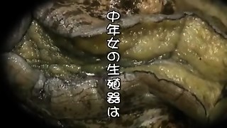 Mom not daughter-in-law and not sonnie